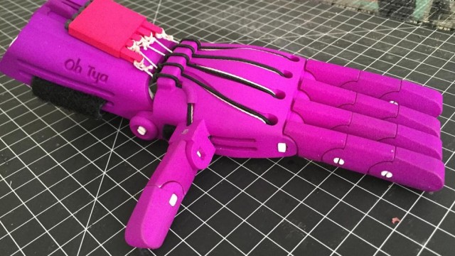 Tya's customized 3D prosthetic hand